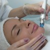 Hydrafacial-behandeling